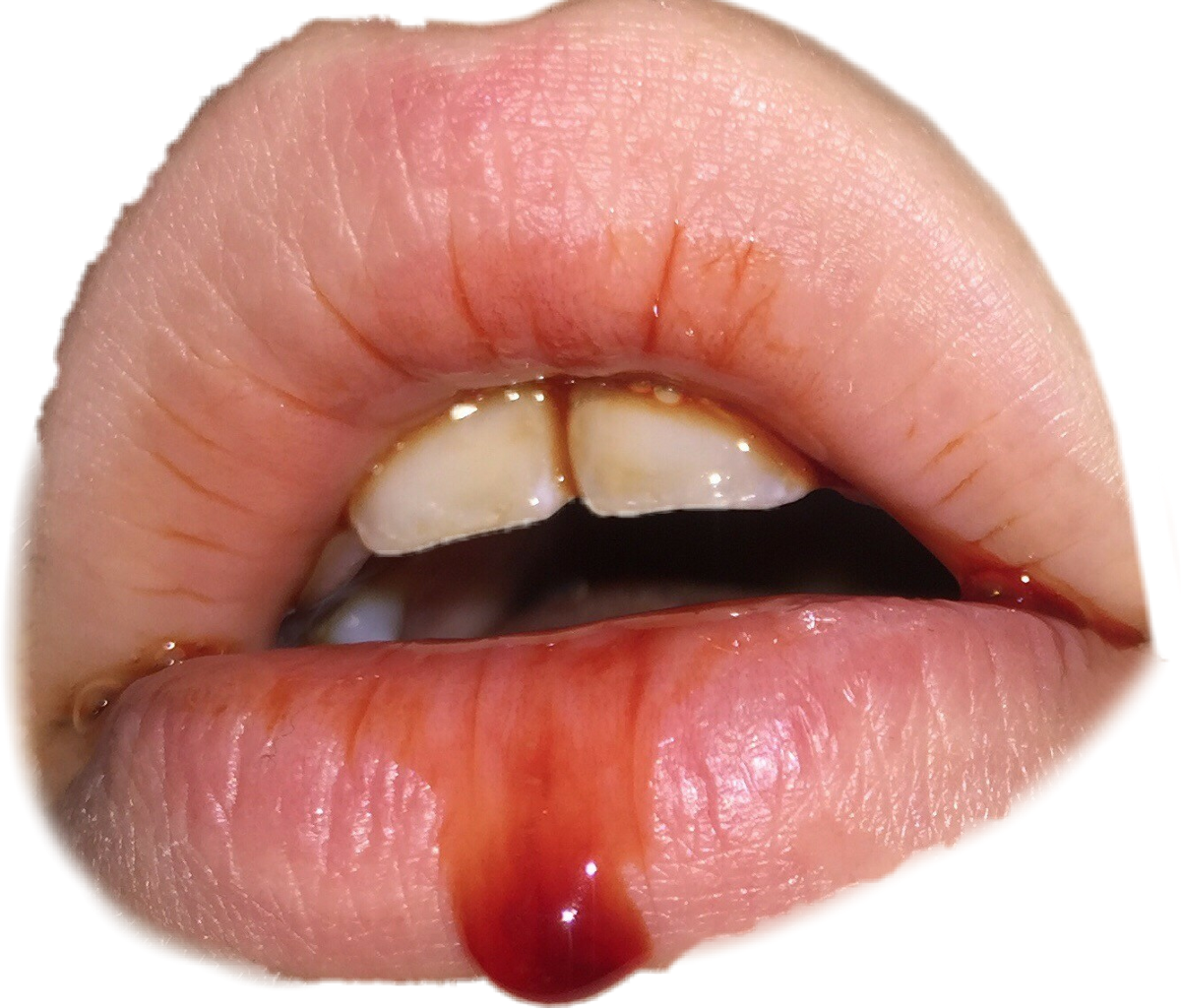 Blood Sad Death Spooky Sad Lips Teeth - Death (1200x1024), Png Download
