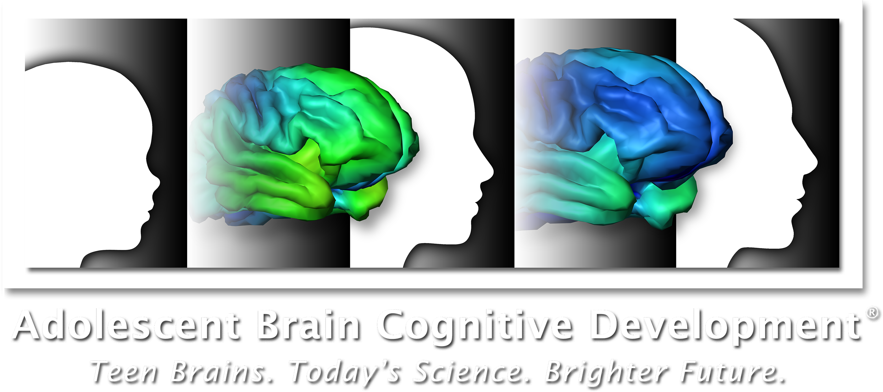 Logo Abcd Ondark Lg - Brain (3000x1430), Png Download