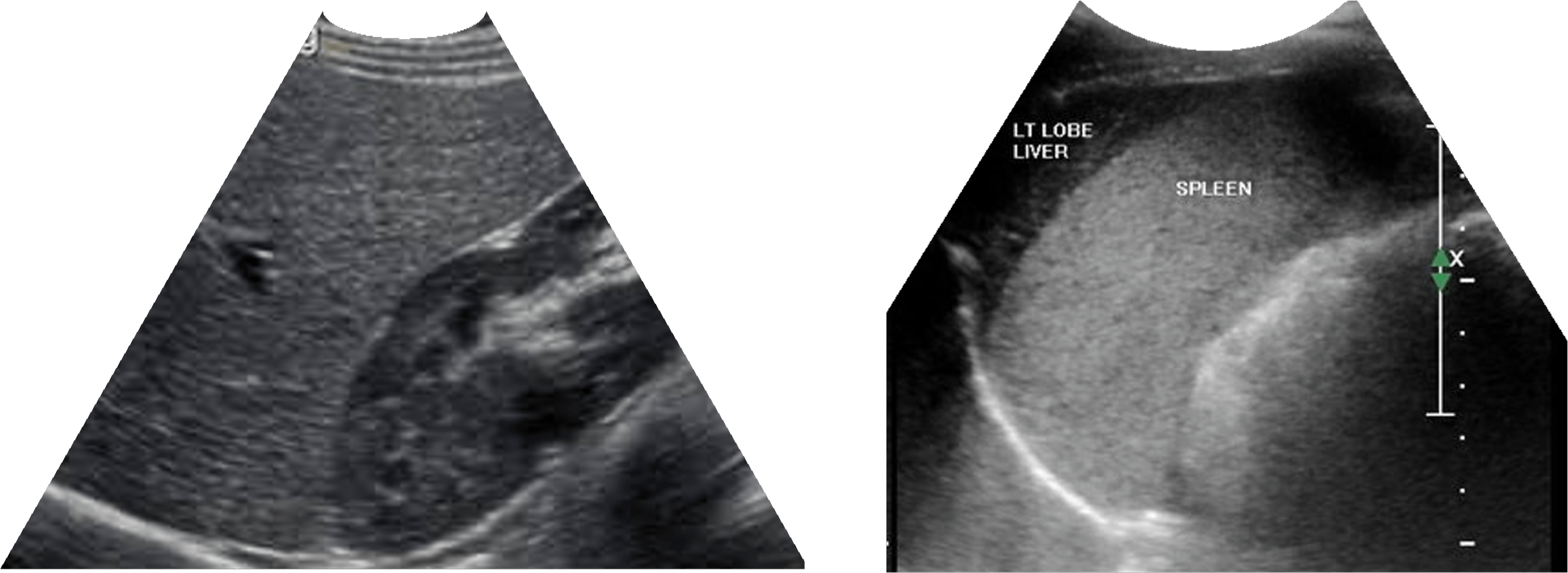 Liver And Spleen2 - Liver (3000x1060), Png Download