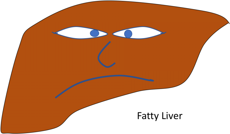Non-alcoholic Fatty Liver Disease (1200x600), Png Download