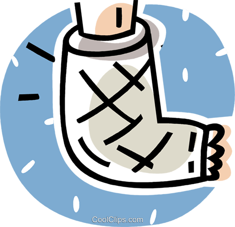 Baby Feet Pictures Clip Art - Broken Foot Cast (480x464), Png Download