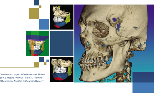 Skull (539x325), Png Download