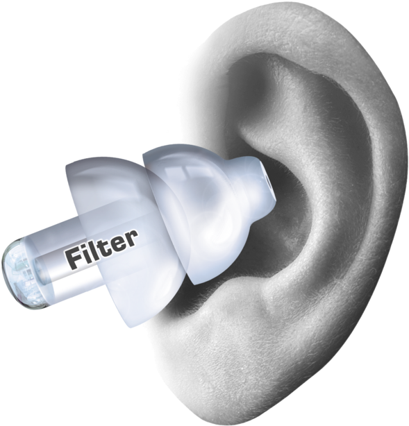 50alpine Partyplug Transparent Ear - Alpine Hearing Partyplug Single-attenuator Molded Earplugs (1000x823), Png Download