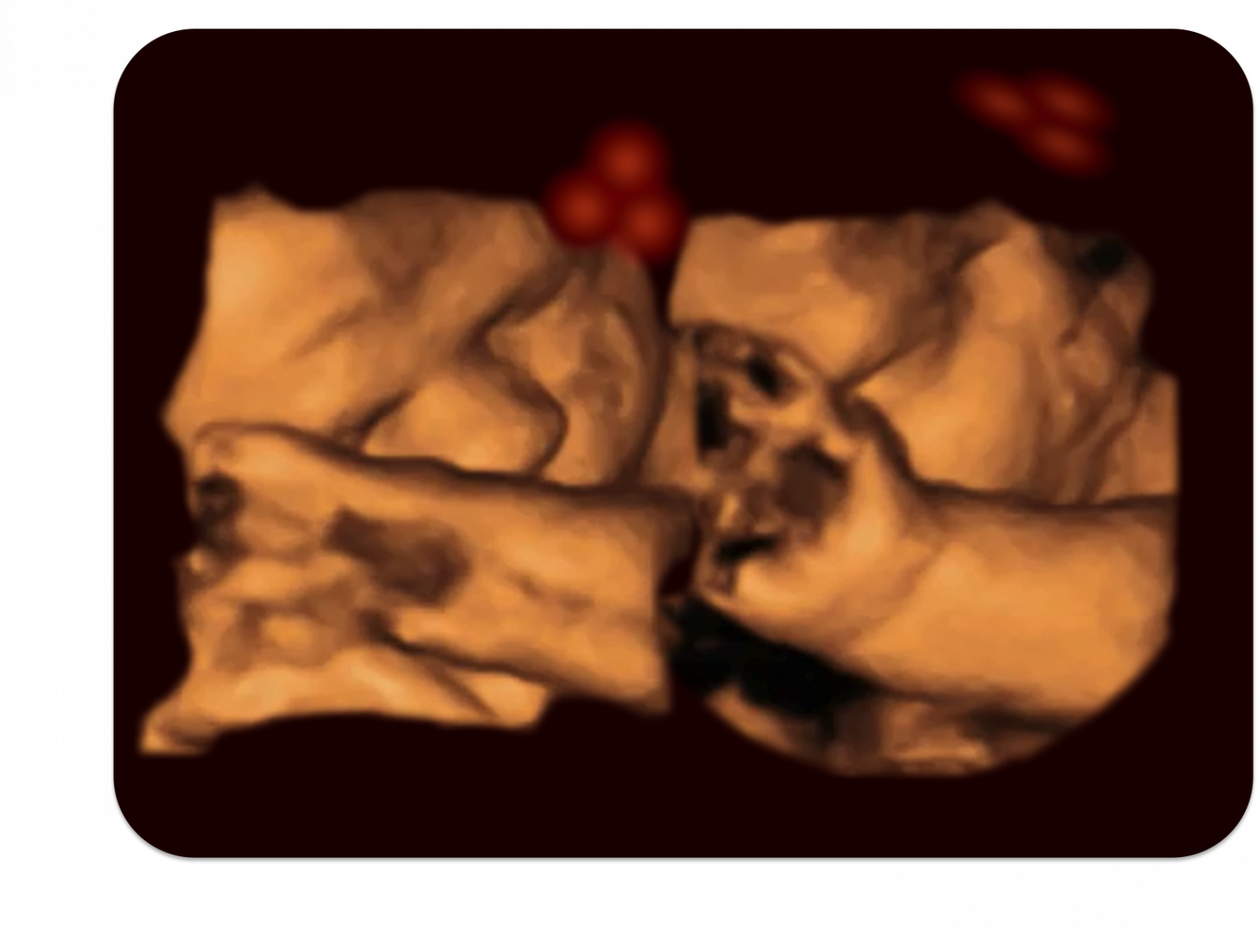 A 4-d Ultrasound Of A Fetus Tracking The Stimulus - Καλο Μηνα Μωρο (1500x1134), Png Download