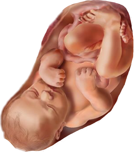 Fetus (450x502), Png Download
