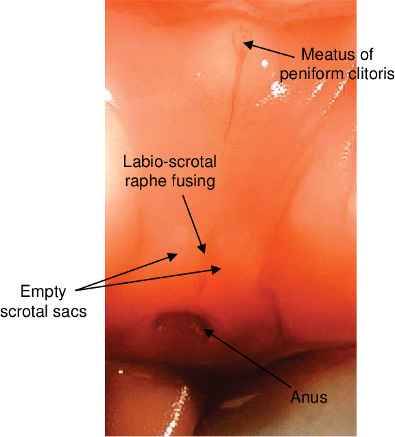 External Genital Development Of A Female Spotted Hyena - Clitoris Developing (576x636), Png Download
