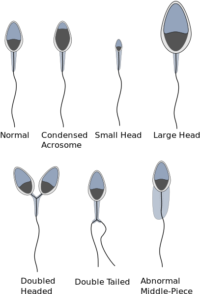 Regarding Sperm Morphology - Horse Sperm Cell (440x631), Png Download