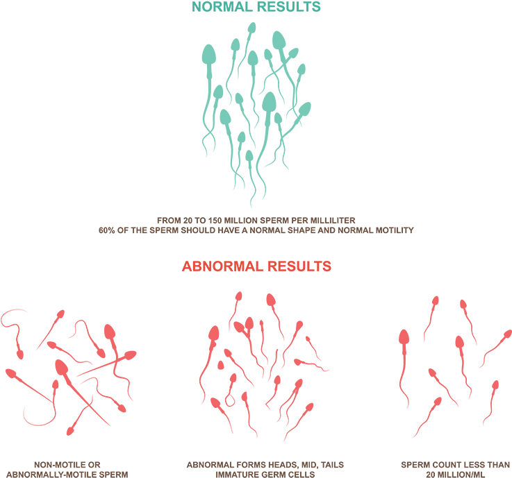 Teratospermia/ Teratozoospermia Might Perhaps Be The - 精蟲 活動 力 (800x743), Png Download