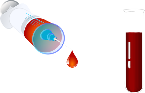 ¿qué Examina Un Examen De Sangre - Blood Test Tube Png (500x323), Png Download