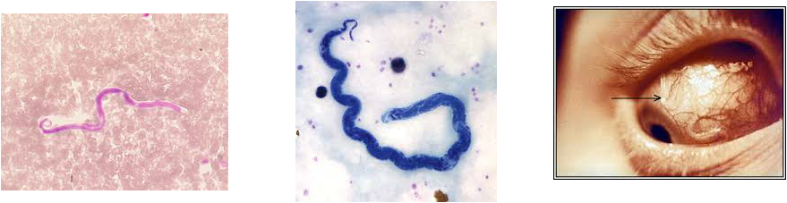 Picture - Loa Loa (879x227), Png Download