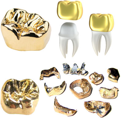 Gold Teeth Caps We Buy Gold Salem - Gold Crown Tooth (400x400), Png Download