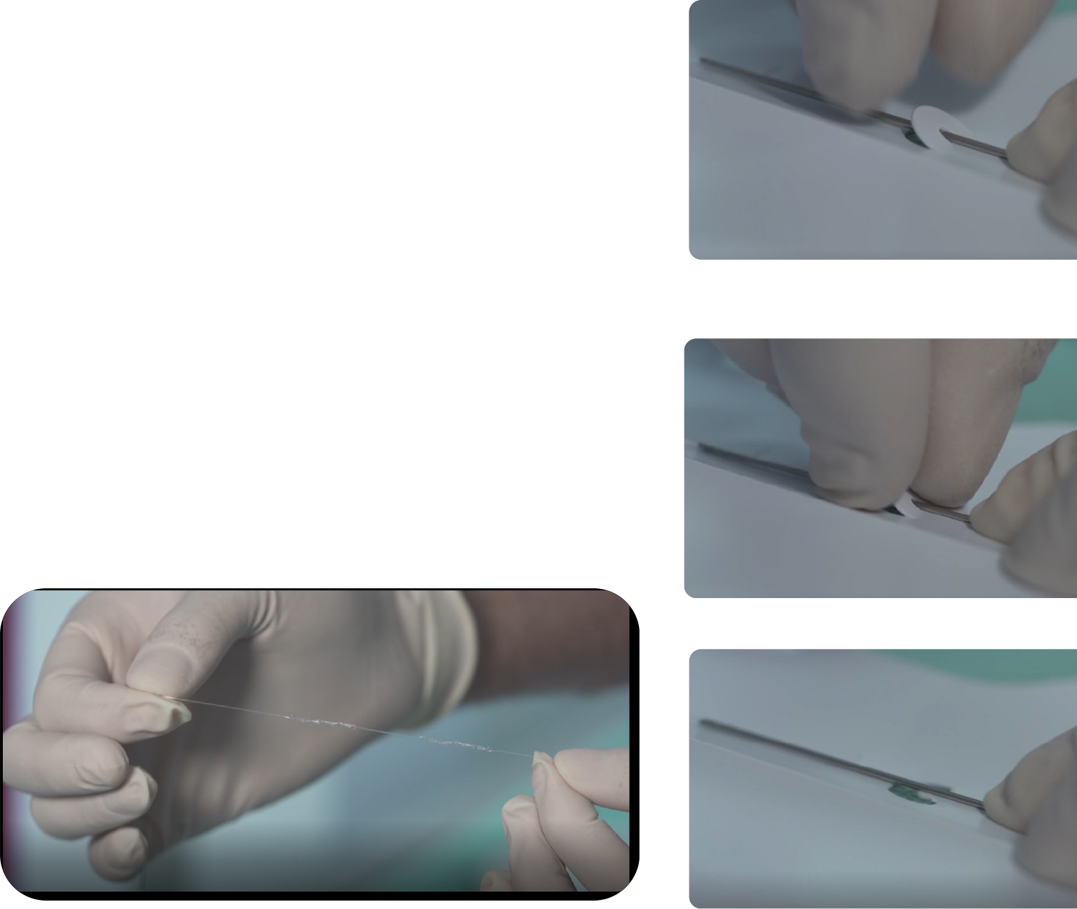 Toe (1534x1295), Png Download
