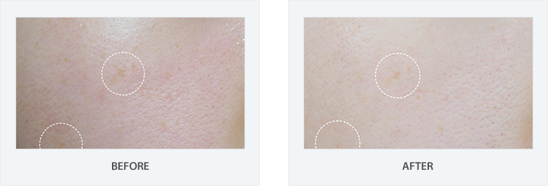 Trian Ampule - Ampoule (778x264), Png Download