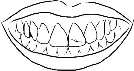 Repair Damage - Outline Image Of Teeth (480x360), Png Download