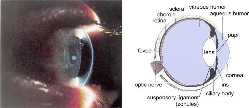 קטרקט - Human Eye (900x375), Png Download