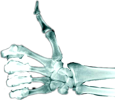 Skeleton Hand Thumbs Up (461x401), Png Download