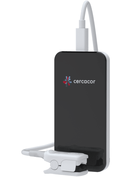 Ember - Tracking System (720x705), Png Download