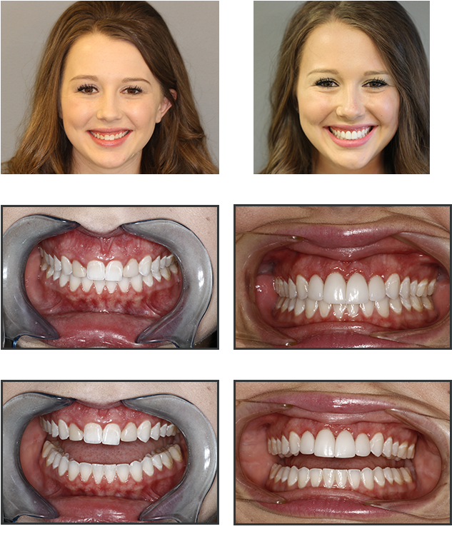 Move The Arrows On Each Image To The Left, To View - Throat (632x771), Png Download