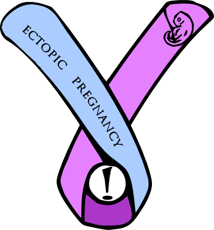 I Was Playing Around With Some Stuff And Whipped This - Symbol For Ectopic Pregnancy (424x456), Png Download