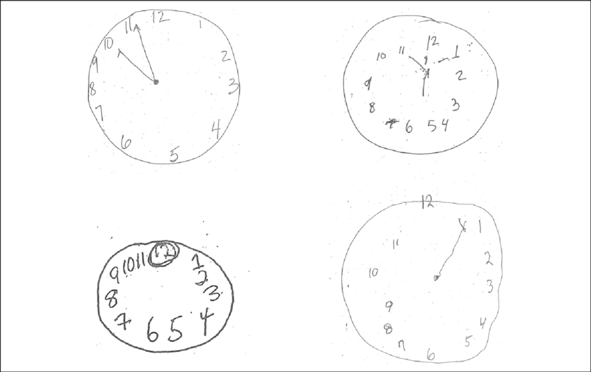 Upper Left, Concrete Error With Misplacement Of The - Circle (850x535), Png Download