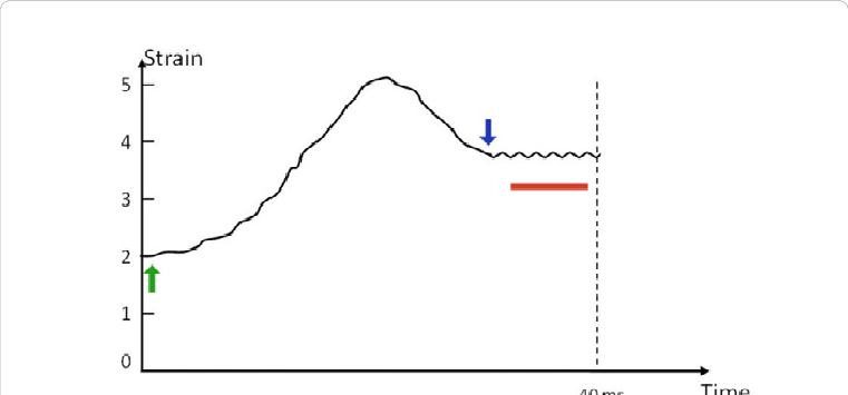 The Tissue Strain Response To A Cw Stress - Diagram (761x355), Png Download