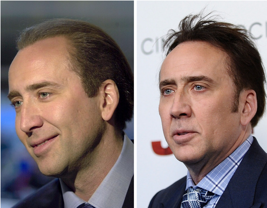 Download Nicolas Cage 2001 Vs Celebrity Men With Hair Pieces