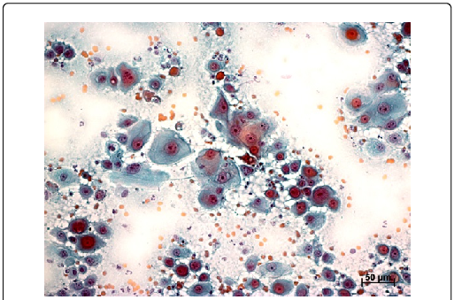 Nucleus And Nucleolus Criteria - Nucleolus (513x339), Png Download