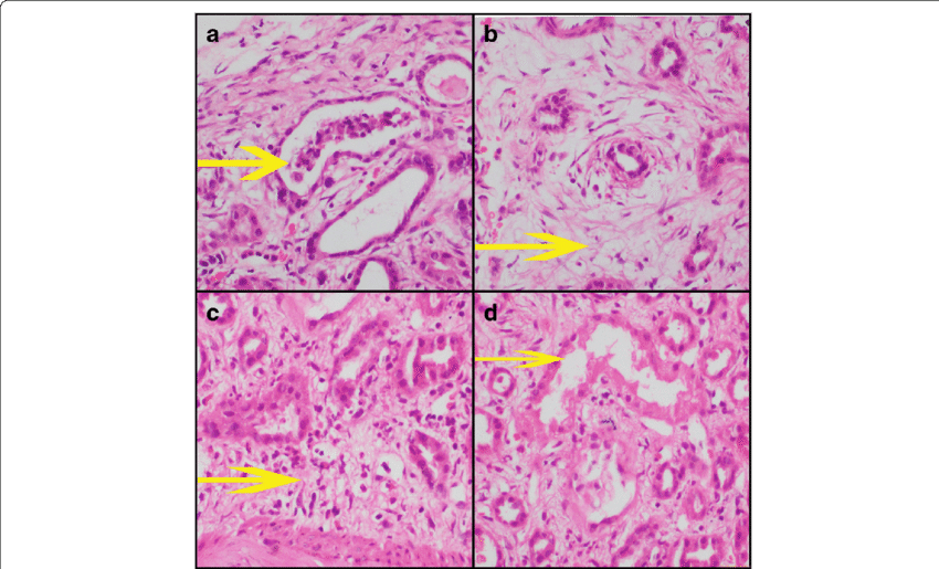 Yellow Arrow Depicts As Follows - Tubule (850x515), Png Download