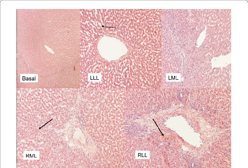Histological Damage In Biopsy Specimens Taken After - Circle (497x337), Png Download