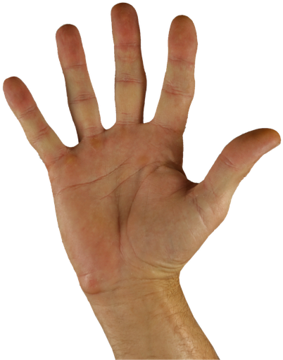 Five Things Open Palm - Sabañones En Las Yemas De Los Dedos (960x640), Png Download
