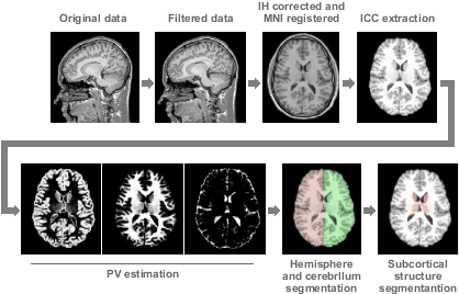 However This Time Can Vary Depending On The Number - Computed Tomography (428x292), Png Download