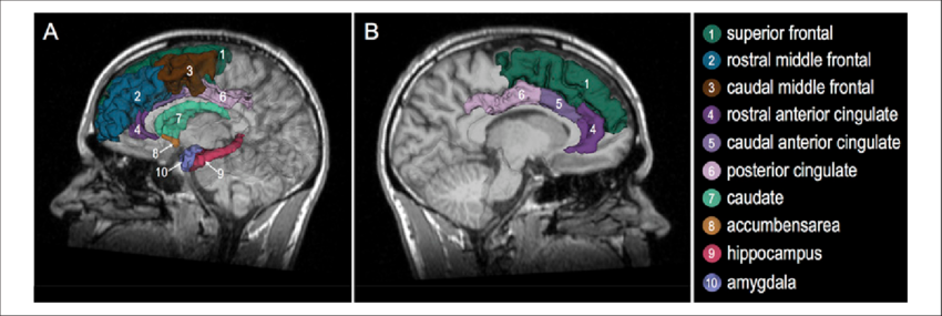 3-d Model Of The Human Brain Superimposed On The Mri - Human Brain (850x285), Png Download