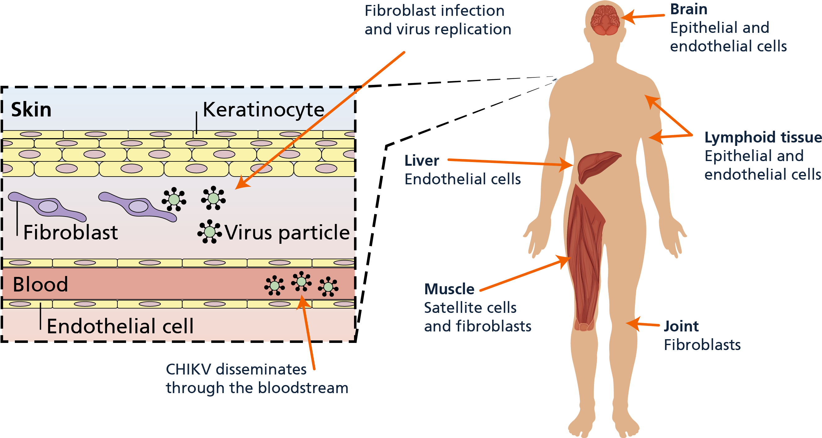 06 Pm 61359 Clinical Manifestation - Diagram (2756x1413), Png Download