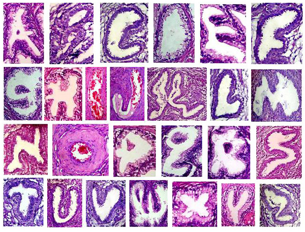 A Glandular Font, Courtesy Of Dr - Histology Alphabet (600x457), Png Download