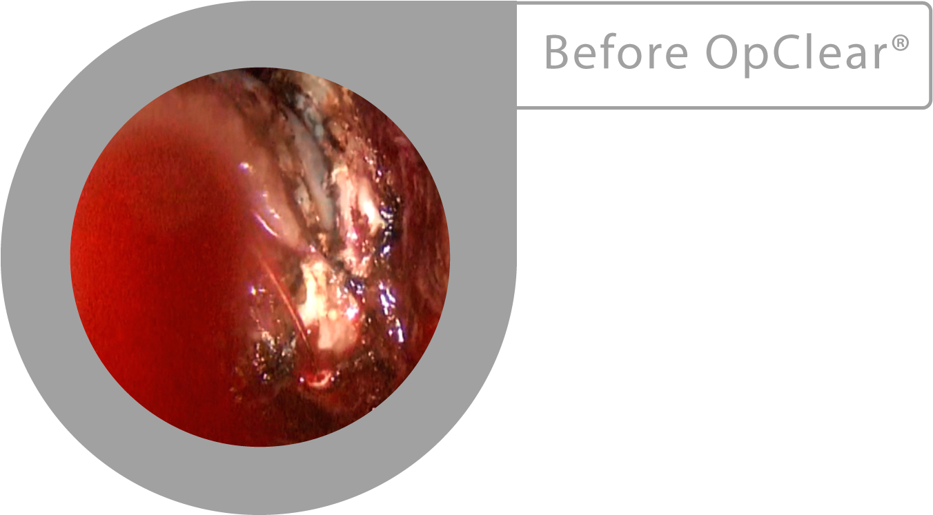 Opclear® Removes Blood - Spiral Galaxy (1404x796), Png Download