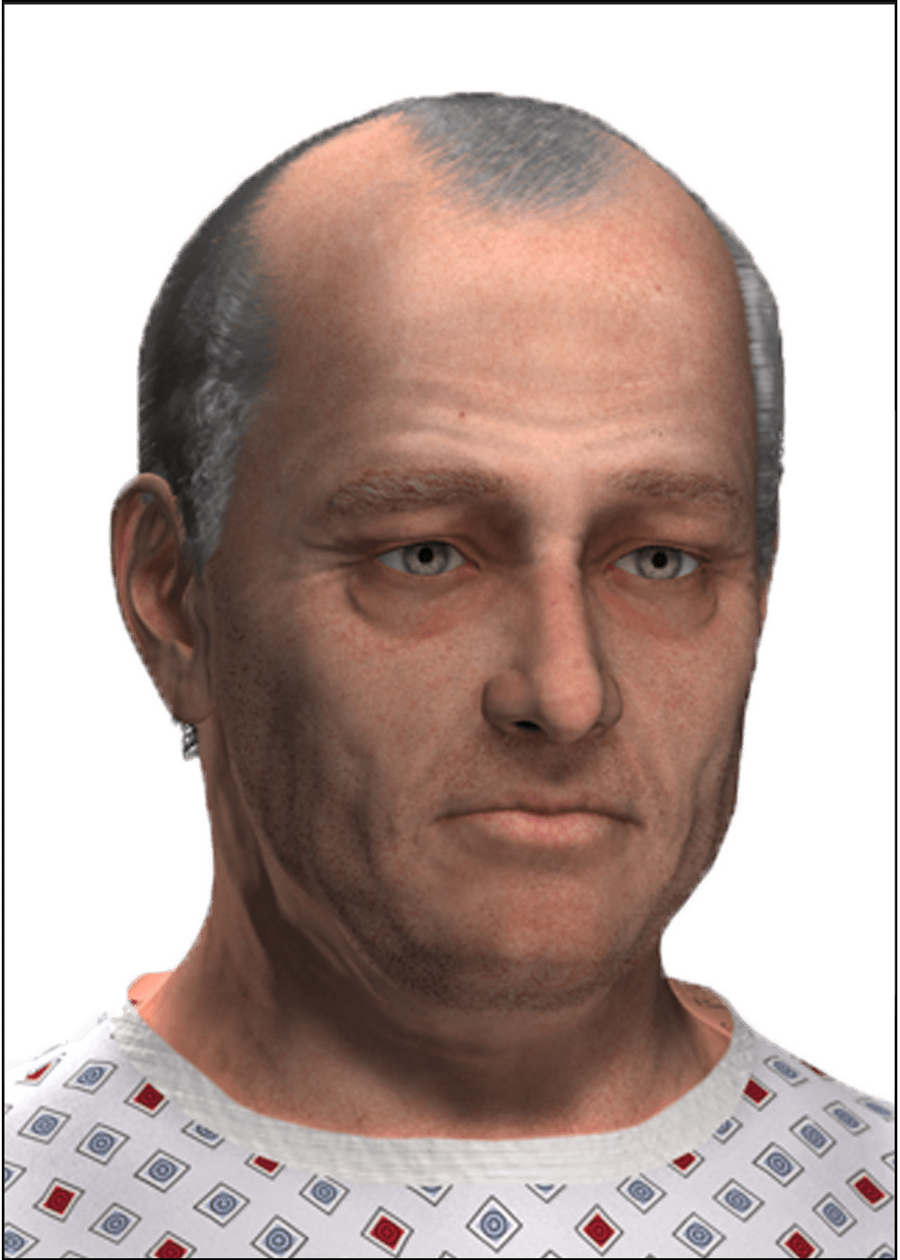 Case Presentation - Romas Zamolskis (1000x1400), Png Download