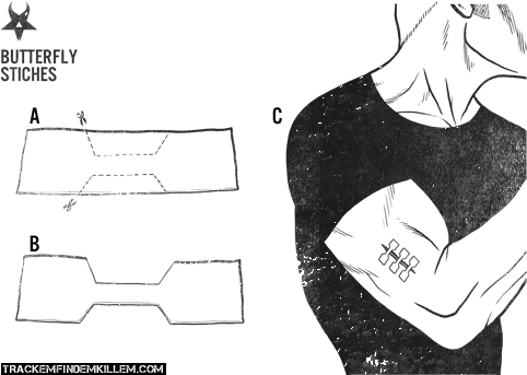 Butterfly Closure A - Diagram (500x365), Png Download
