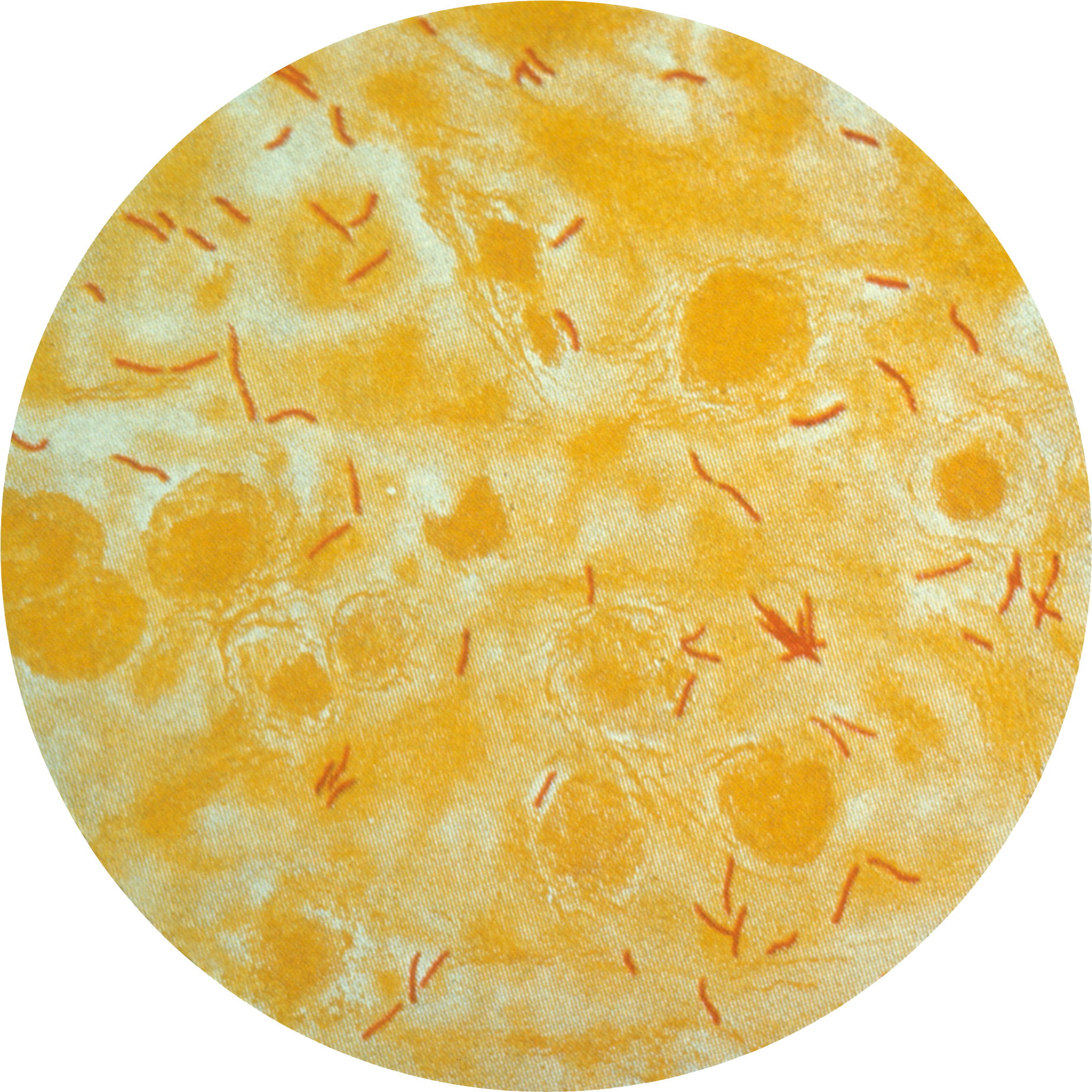 Tb In Sputum - Mycobacterium Tuberculosis (2047x2047), Png Download
