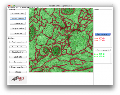 Deep Learning Segmentation Gui (400x318), Png Download