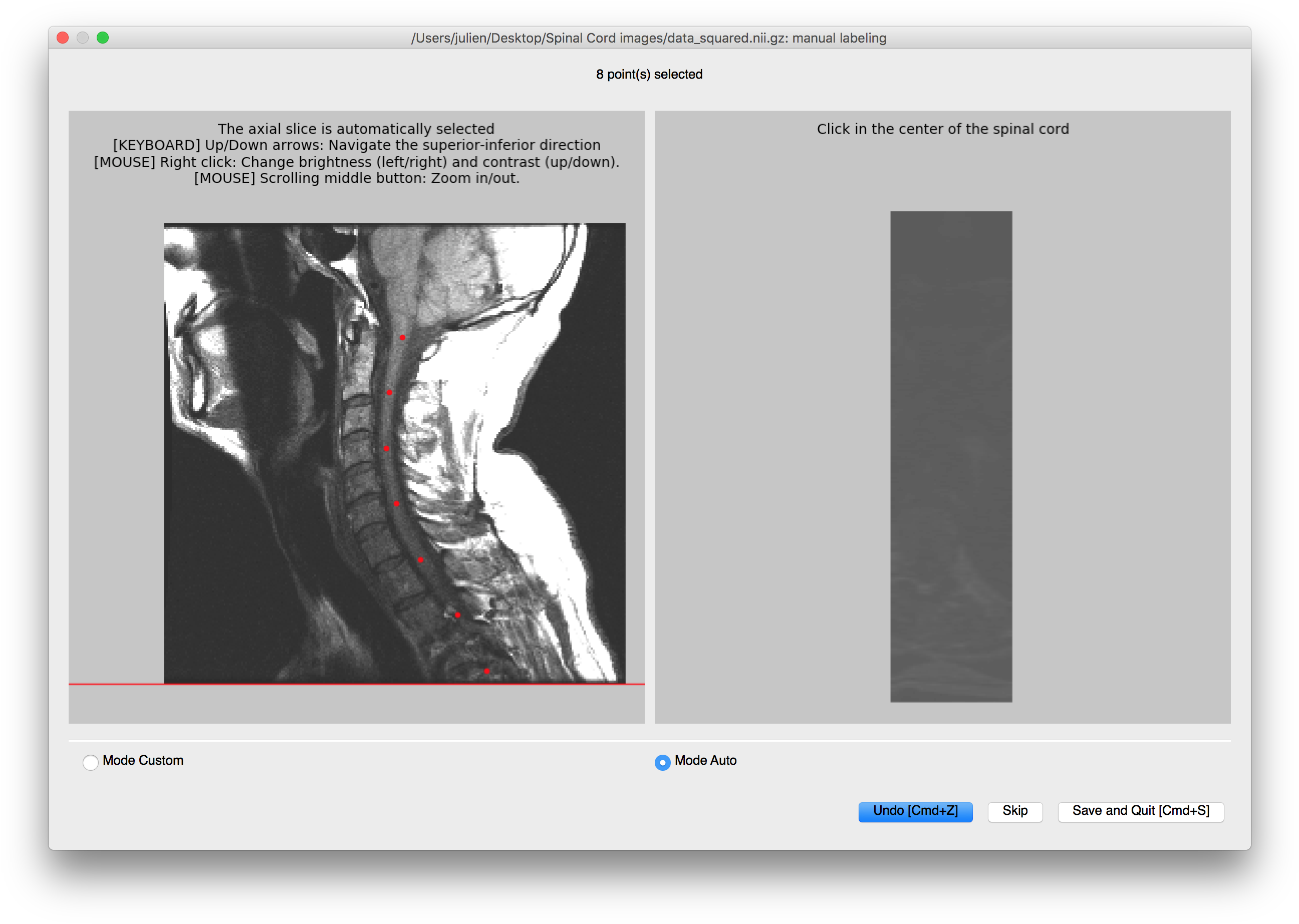 Results - Computed Tomography (2624x1868), Png Download