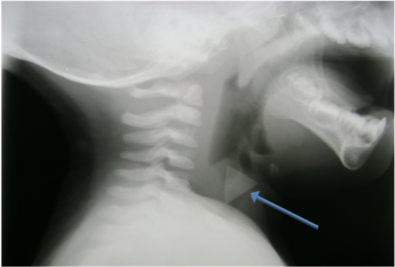 Medical Radiography (903x373), Png Download