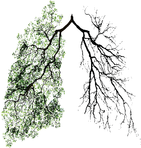It's All A Game Open And Accepting - Tree Art Tumblr Transparent (485x589), Png Download