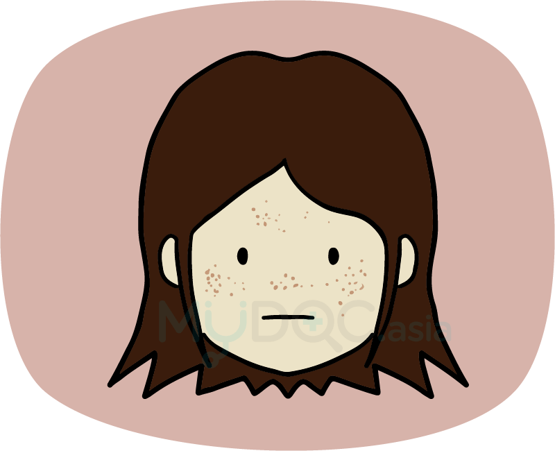 Pigmentation On Face-freckle - Freckle (800x650), Png Download