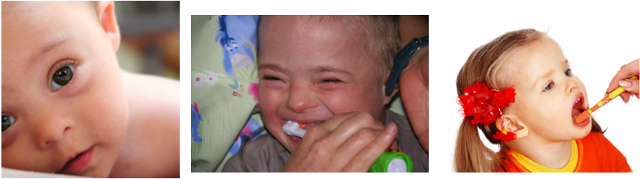 Periodontics And Down Syndrome - Toddler (901x253), Png Download