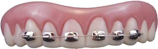 10112 Fool-all Brace - Braces For False Teeth (600x240), Png Download