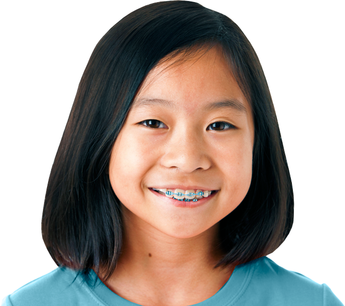 Girl-braces - Girl Braces Transparent Png (675x600), Png Download