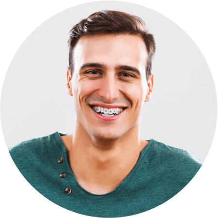 Metal Braces - Adult Braces (450x450), Png Download