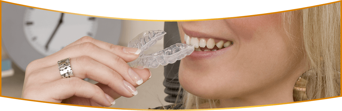 Clear Braces San Luis Obispo Ca - Clear Aligners (1200x390), Png Download