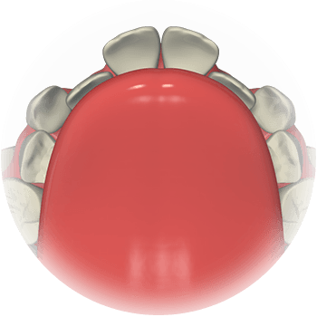 Modern Research Has Shown That Crowded Teeth, Incorrect - Orthodontics (350x350), Png Download