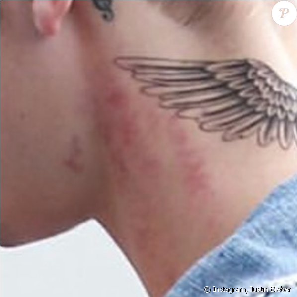 Justin Bieber Et Ses Rougeurs, Décembre - Justin Bieber Tattoo Ense (950x597), Png Download